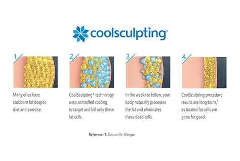 coolsculpting gold coast|Coolsculpting — Advanced Dermatology.